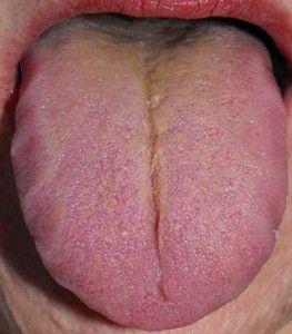 Señales de tu salud en tu lengua